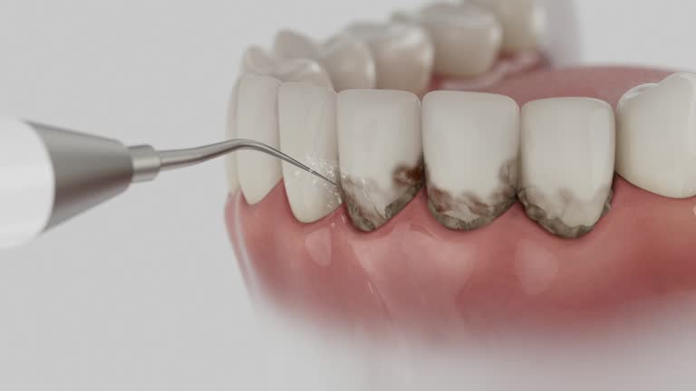 Reliable Emergency Dentist contractor in Isabella County County, MI by Dentist Open Now